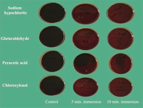 blood agar plate results|1.19: Blood Agar .